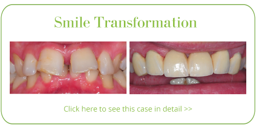 Cosmetic Dentist Skegness